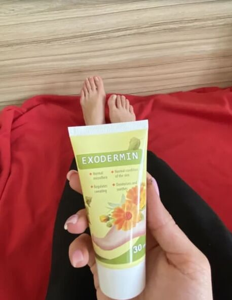 Review on Exodermin cream from Yesenia